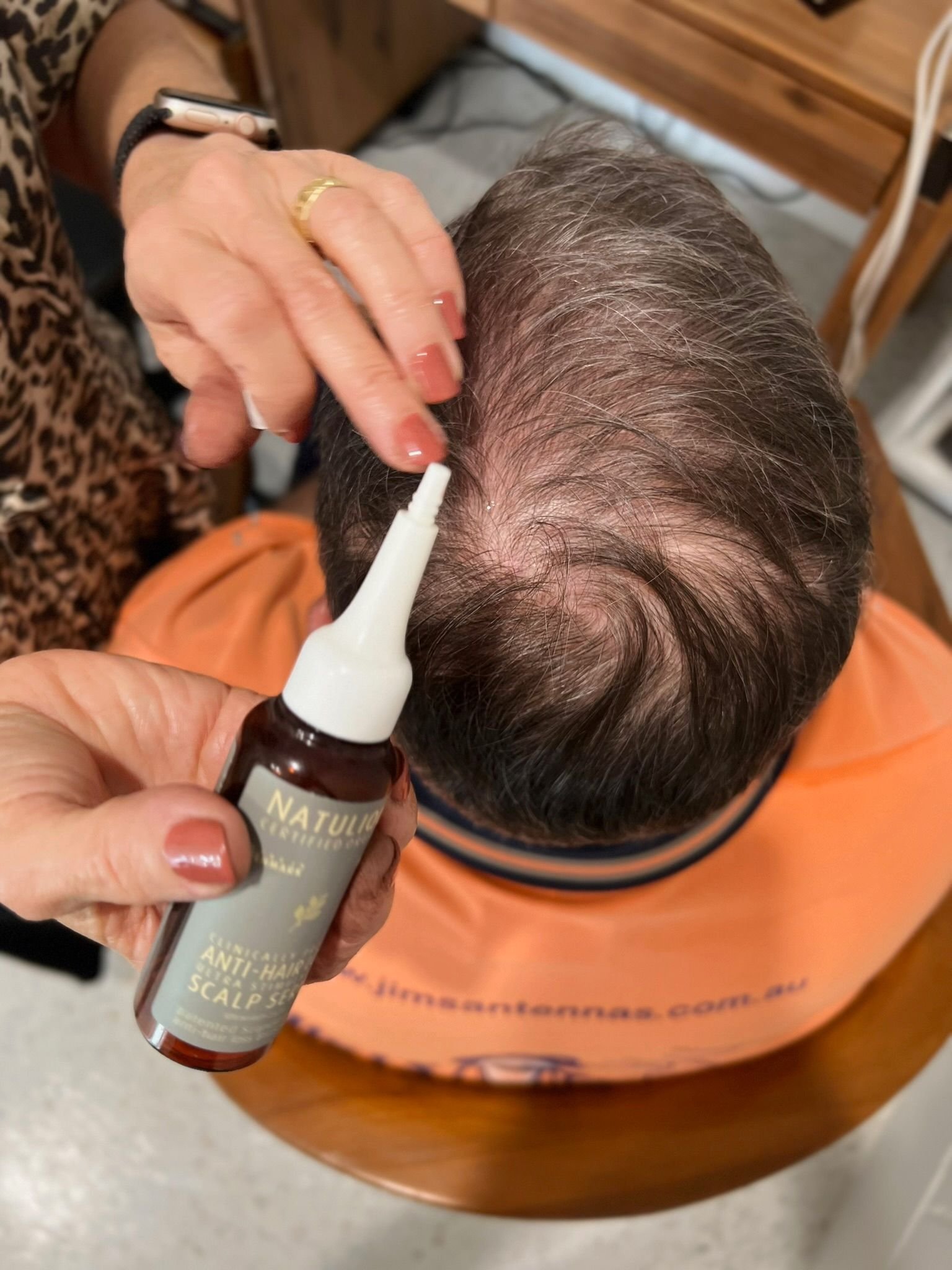 Trichology consultation and scalp analysis at About Hair Mackay, example 1