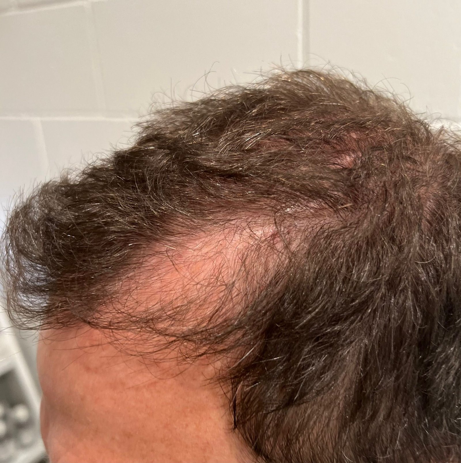 Trichology consultation and scalp analysis at About Hair Mackay, example 6