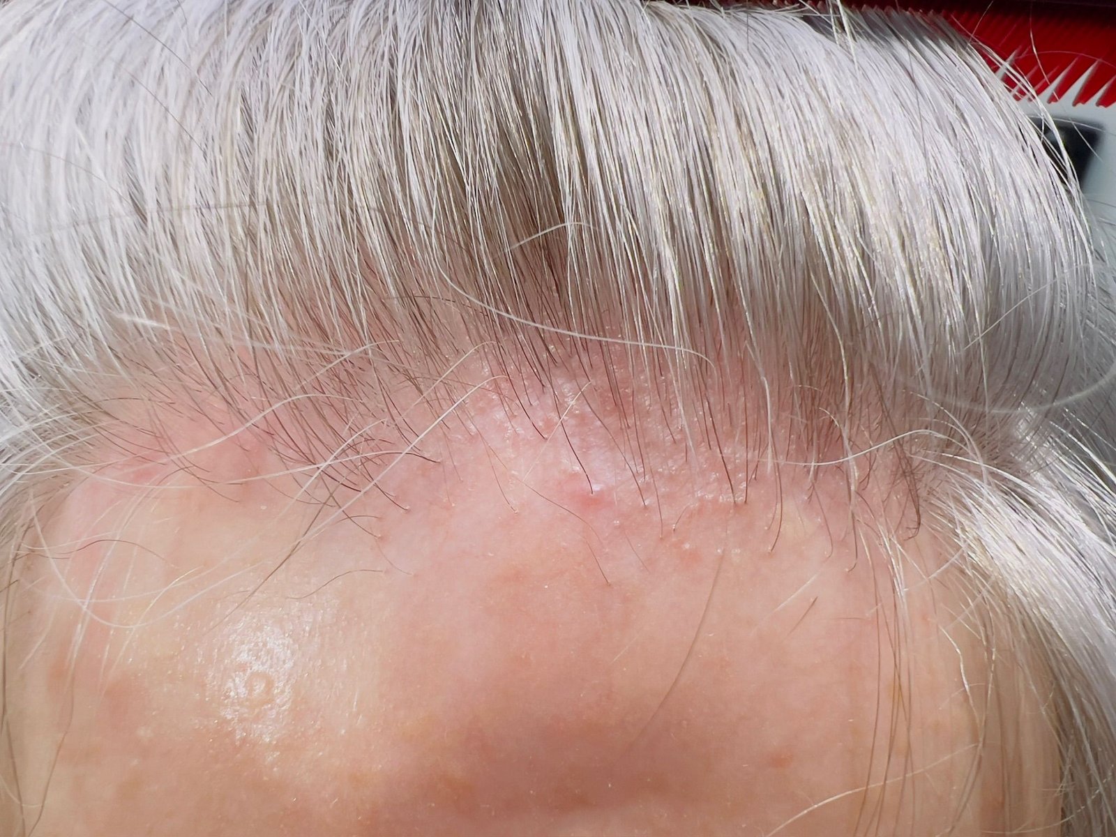 Trichology consultation and scalp analysis at About Hair Mackay, example 7